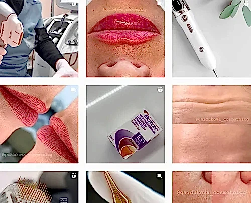 Чередовали посты и видео